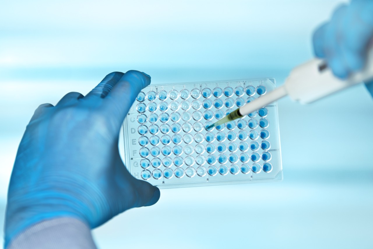 hands of scientist in the biochemical lab with pipette and multiwells plate / technician pipetting plate multiwell in the laboratory