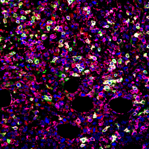 Immunohistochemistry