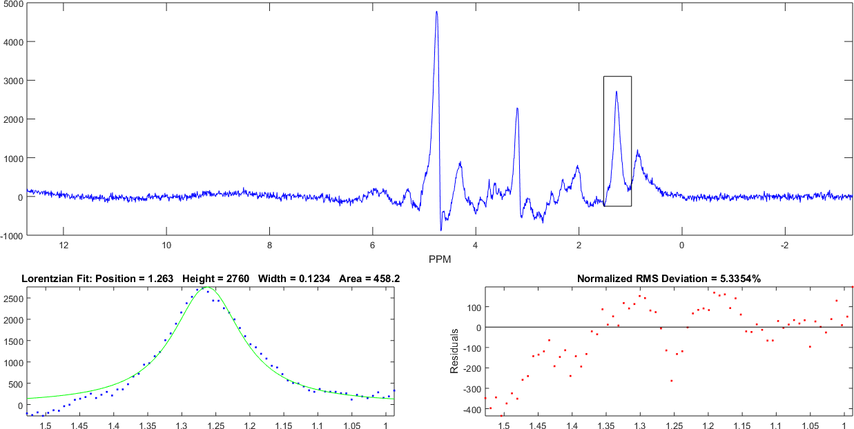 Interactive Measurement of Brain Metabolites Using SIFT™ for MRS Analysis